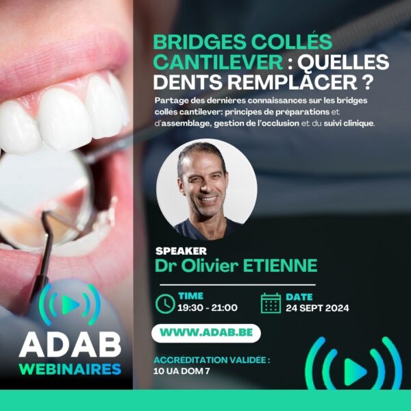 webinaire accrédité dentistes sur les bridges collés cantilever avec Dr Olivier Etienne